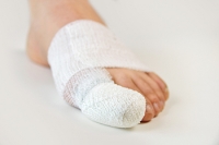 What Is a Stubbed Toe?