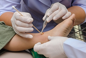 Elderly People and Foot Wounds