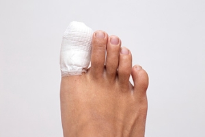 What Are the Symptoms of a Sprained Toe?