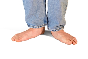 What Are Flat Feet?